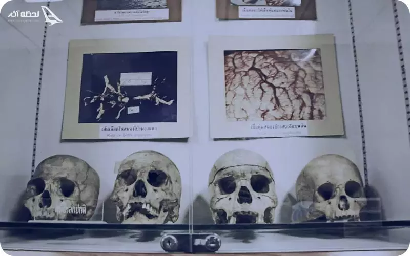 موزه پزشکی بانکوک