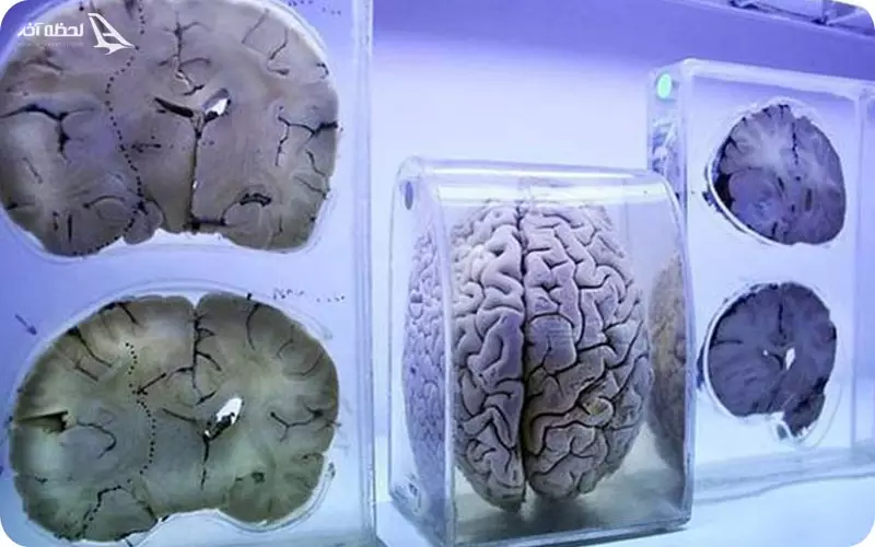 موزه مغز انسان